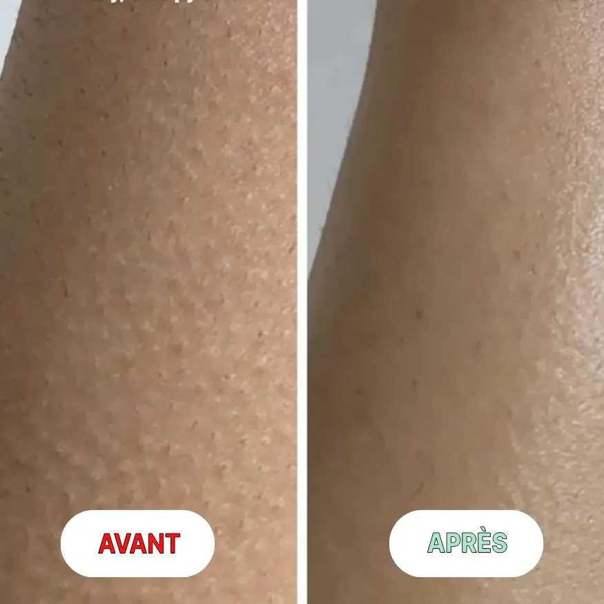 Résultats après la première utilisation du gant exfoliant en soie